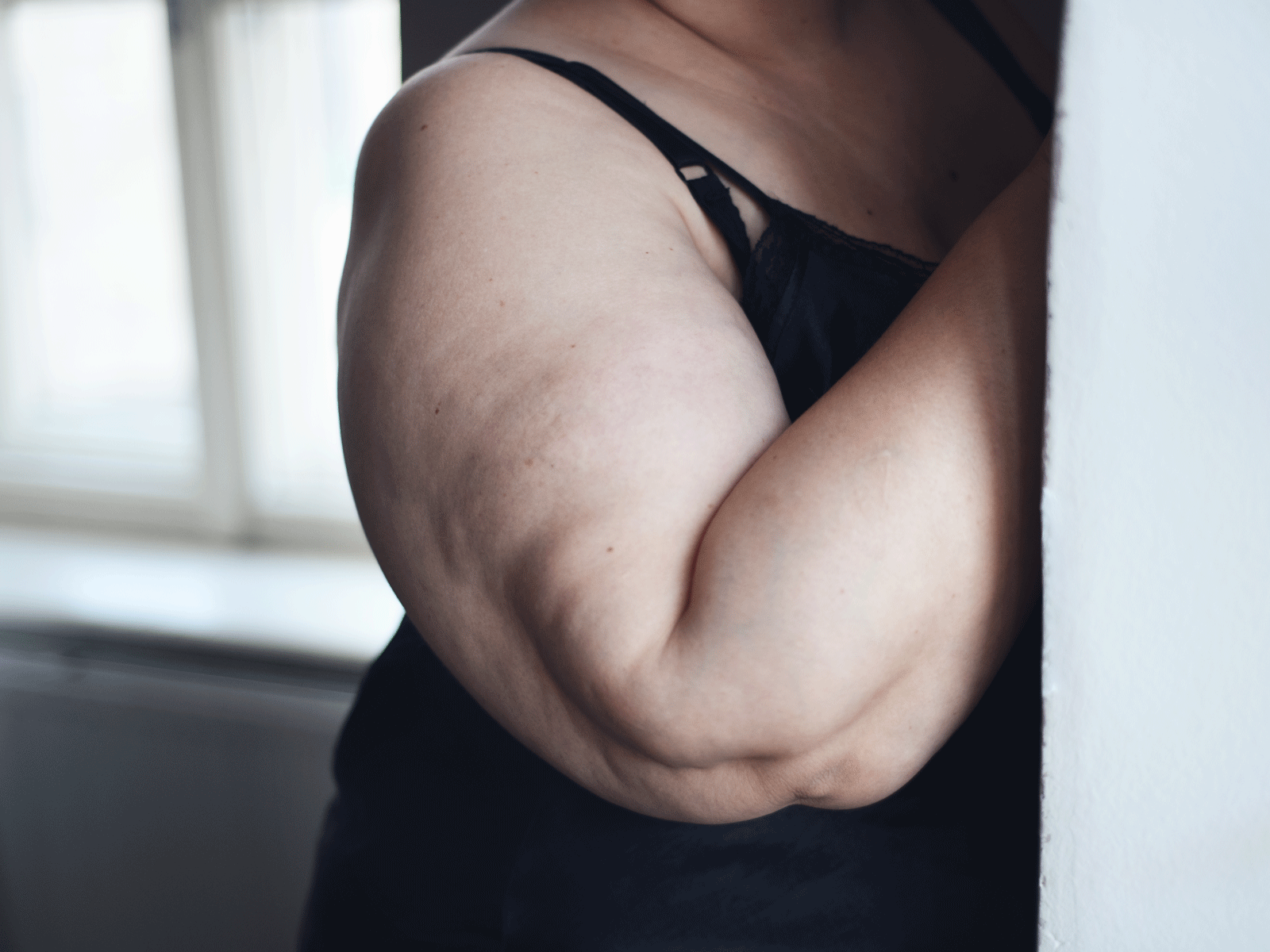 How to get rid of cellulite on your arms: exercises and remedies